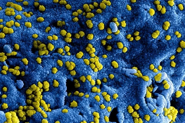 WHO pandemic agreement unresolved pathogen acce… WHO pandemic agreement unresolved pathogen access and benefit sharing annex